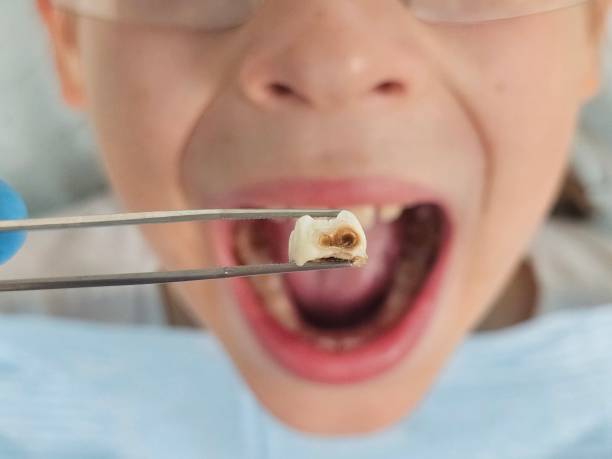 Best Walk-In Emergency Dental Services in Minot Af, ND